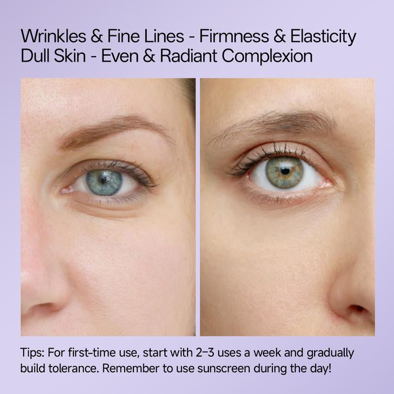 [WNP Official] WNP Retinol Anti-Aging Cream Reduces Wrinkles & Fine Lines, Firms Skin, Boosts Radiance