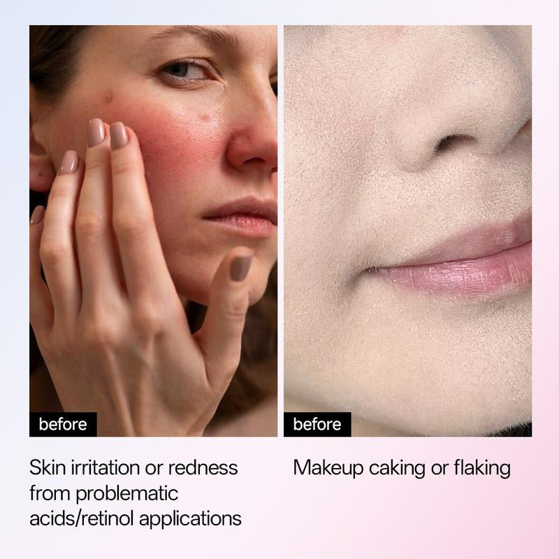 [WNP Official] WNP Retinol Anti-Aging Cream Reduces Wrinkles & Fine Lines, Firms Skin, Boosts Radiance