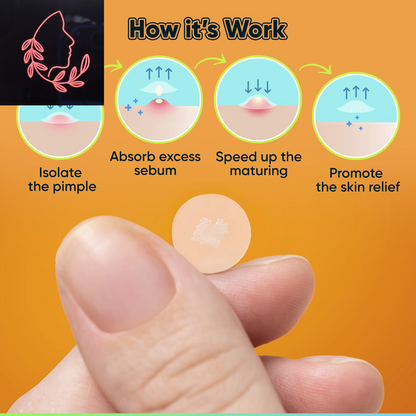 Pimple Party Party Favors: 216 Hydrocolloid Stickers for Your Face's Unwanted Guests with a Splash of Tea Tree Oil!