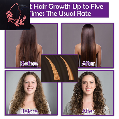 Hair Today, Gone Tomorrow: The Magical Potion Set for Your Thinning, Curly Mane!
